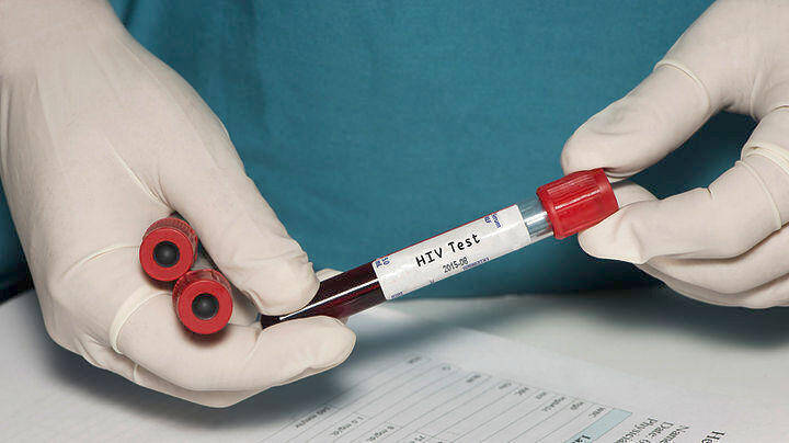 HIV: Δεύτερος ασθενής φαίνεται να απαλλάχτηκε τελείως από τον ιό χωρίς μεταμόσχευση βλαστοκυττάρων!