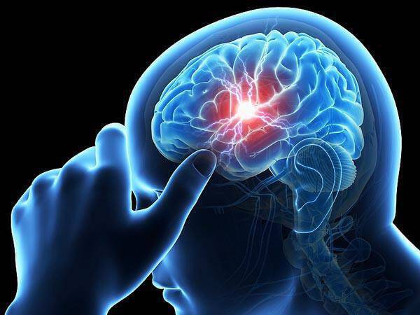 Παγκόσμια Ημέρα κατά των Εγκεφαλικών Επεισοδίων – Τι πρέπει να γνωρίζετε για το εγκεφαλικό