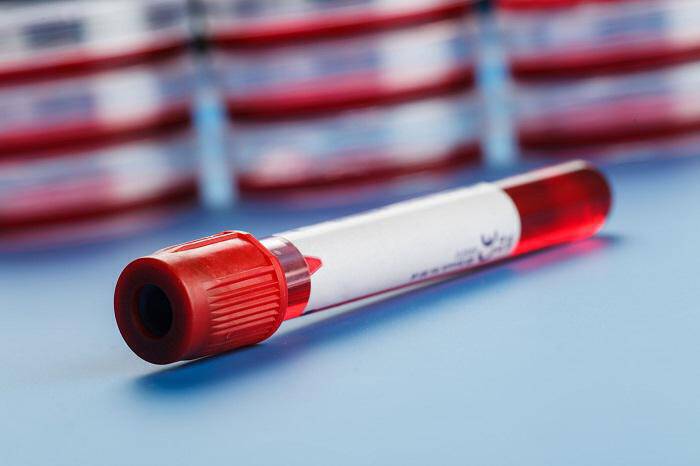 Κορονοϊός: Αιματολογικό τεστ θα αποκαλύπτει την πραγματική εξάπλωση!