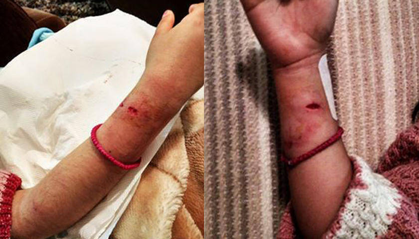 Επίθεση από αδέσποτο σκυλί σε 7χρονο κοριτσάκι στην Μυτιλήνη