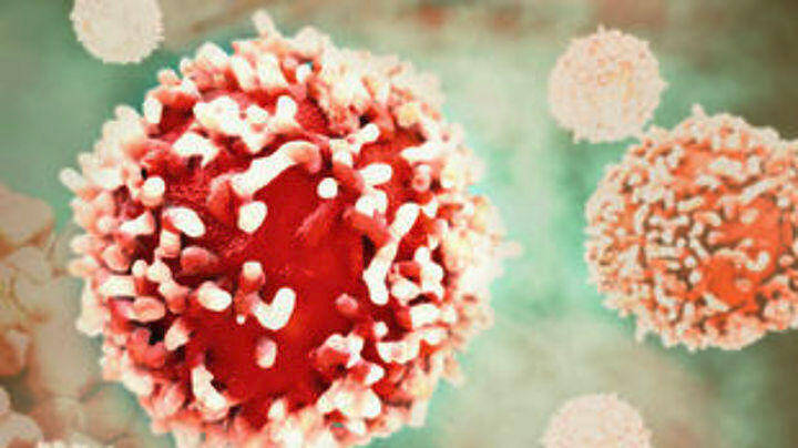 Νέα έρευνα: Οι πολλές αξονικές τομογραφίες αυξάνουν τον κίνδυνο καρκίνου
