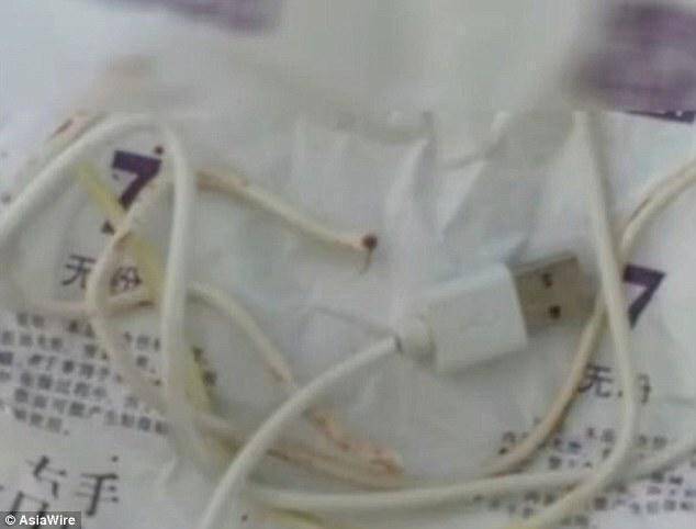 Ένας 13χρονος έβαλε USB καλώδιο στο πέος του και κατέληξε στο νοσοκομείο (vid)