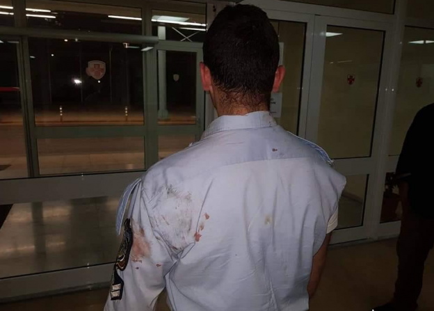 Επίθεση εναντίον περιπολικού σε καταυλισμό Τσιγγάνων – Δύο αστυνομικοί τραυματίες (pics)