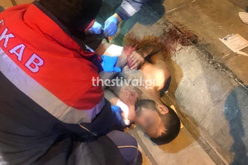 Θεσσαλονίκη: Τους επιτέθηκαν με ξύλα και μαχαίρια για 50 ευρώ (pics)