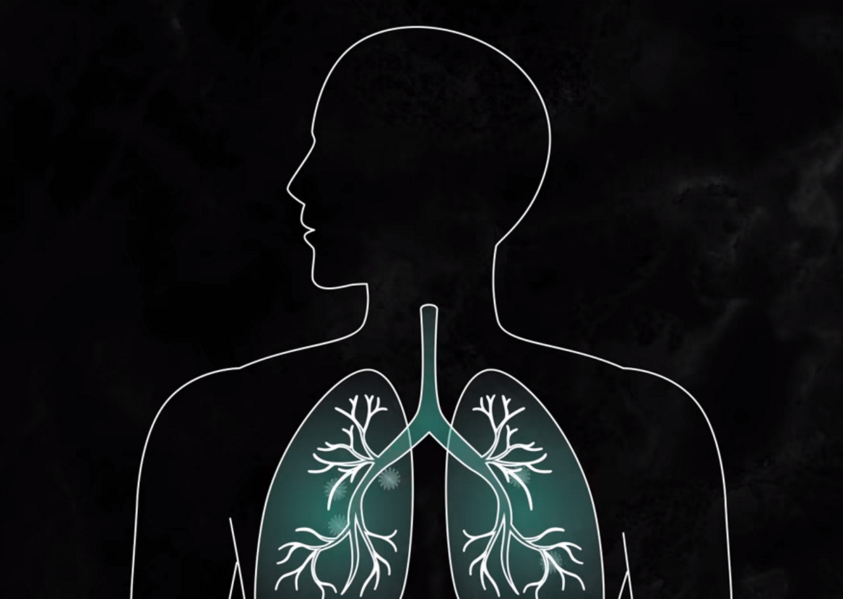 Κορονοϊός: Χρόνια αποφρακτική πνευμονοπάθεια και κάπνισμα αυξάνουν τον κίνδυνο!