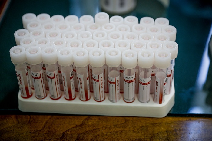Μετάλλαξη Μποτσουάνα: Επανελέγχονται όλα τα PCR τεστ του τελευταίου 15ημέρου