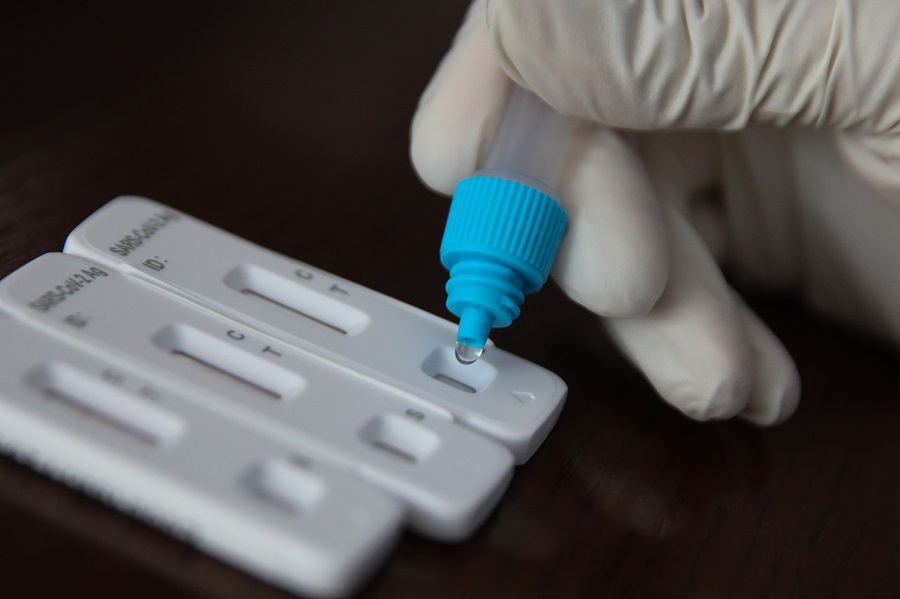 Ο ΕΟΦ ανακαλεί rapid test για κορονοϊό και γρίπη