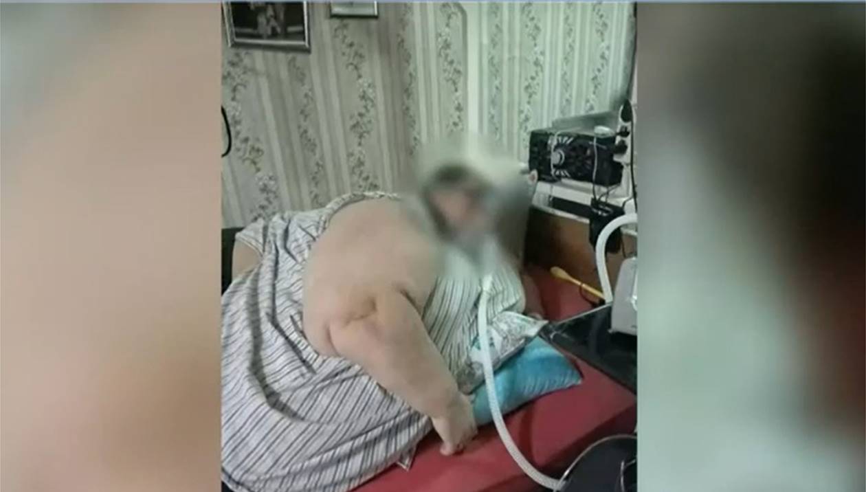 Κομοτηνή: Zυγίζει 360 κιλά και καταγγέλλει το ΕΚΑΒ ότι αρνείται τη διακομιδή του σε νοσοκομείο