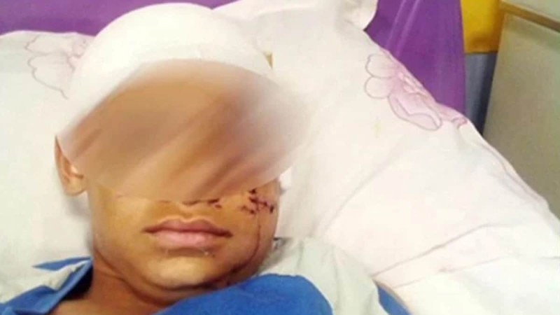 Επίθεση πίτμπουλ σε 11χρονο στην Αρτέμιδα: « Δόντι του σκύλου πέρασε μέσα στο κρανίο» -«Έβαλε το χέρι στο στόμα του τέσσερις φορές»